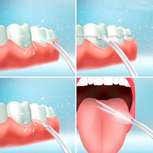 Irrigador Bucal Recargable y Portátil con Cuatro Cabezales - Image 6