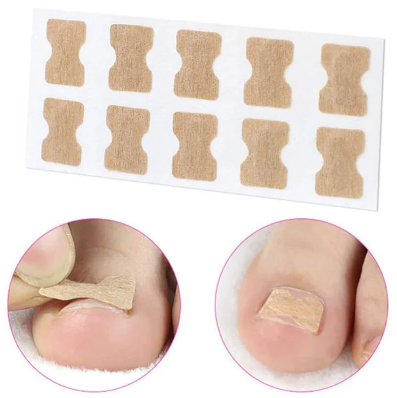 Parches Correctores para Uñas Encarnadas | 50 Piezas - Image 3