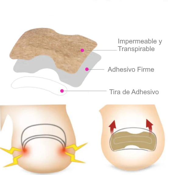 Parches Correctores para Uñas Encarnadas | 50 Piezas - Image 4