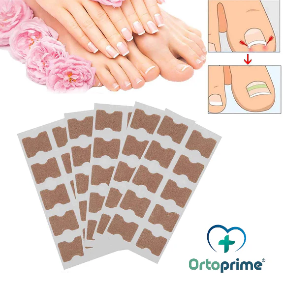 Parches Correctores para Uñas Encarnadas | 50 Piezas - Image 5