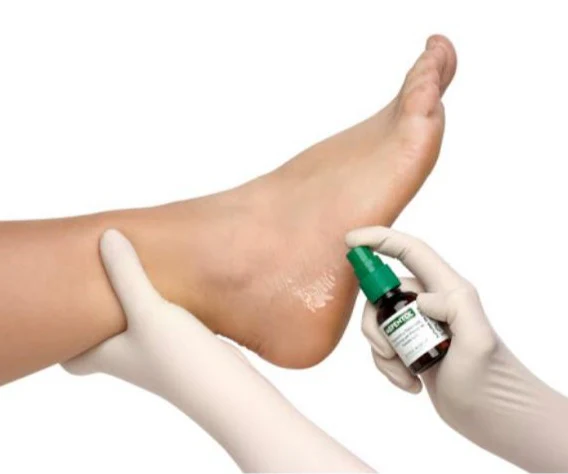 Mepentol Solución Tópica | Prevención y Tratamiento de Úlceras - Image 3